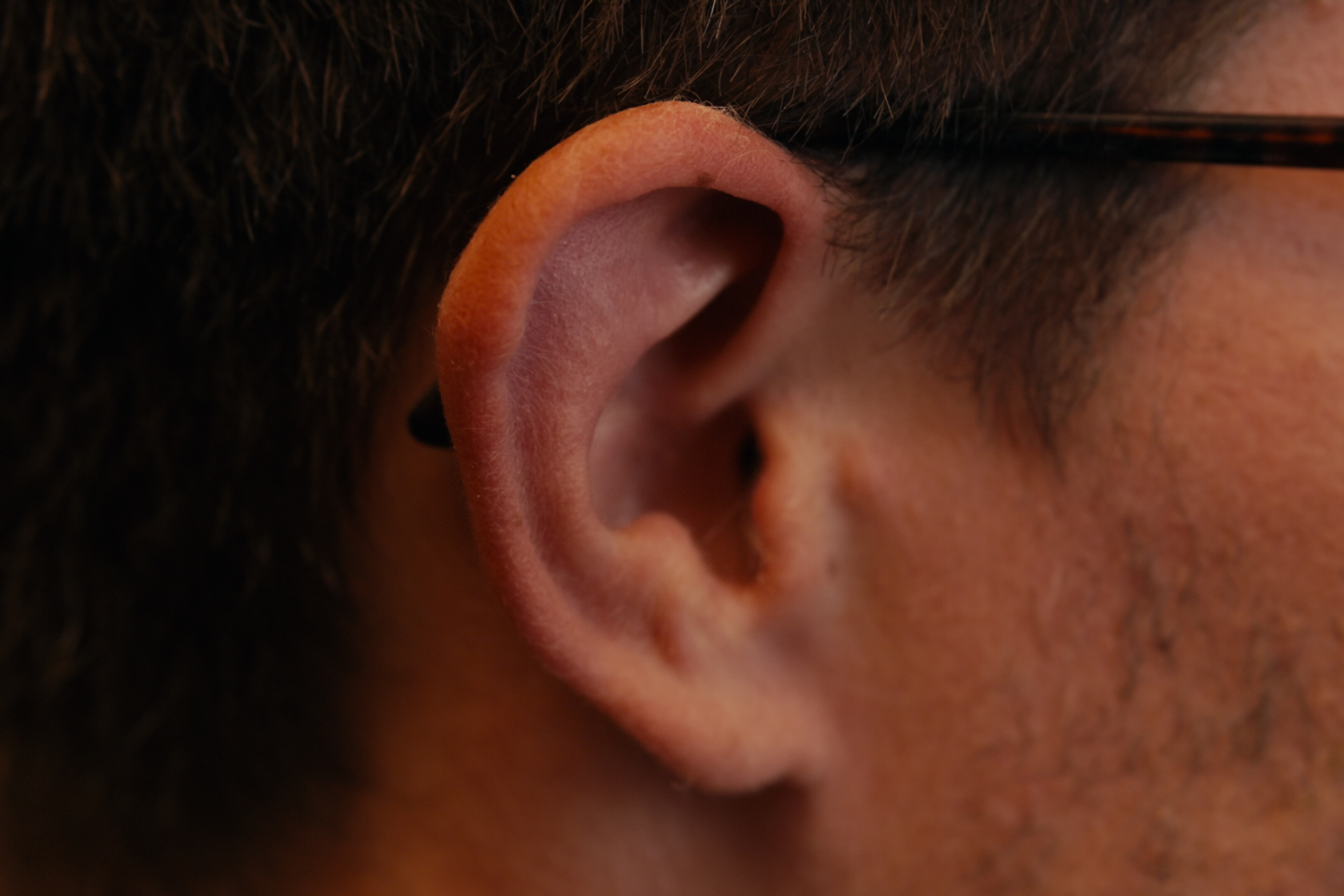 🦻Hearing Loss and Dementia: A Silent Link with Loud Consequences