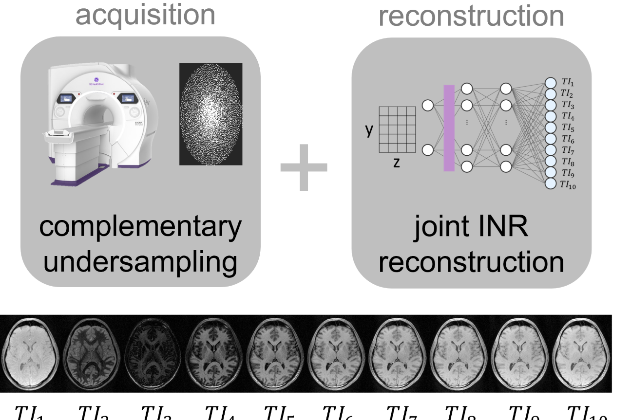 🧲 New MRI Technique to Speed Up Multi-Contrast MRI Scans and Advance Early Alzheimer’s Biomarker Discovery